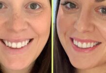 Ліп Блашинг: Всебічний Огляд Напівперманентної Тенденції