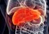 Добавка для печінки може підвищити ефективність лікування раку